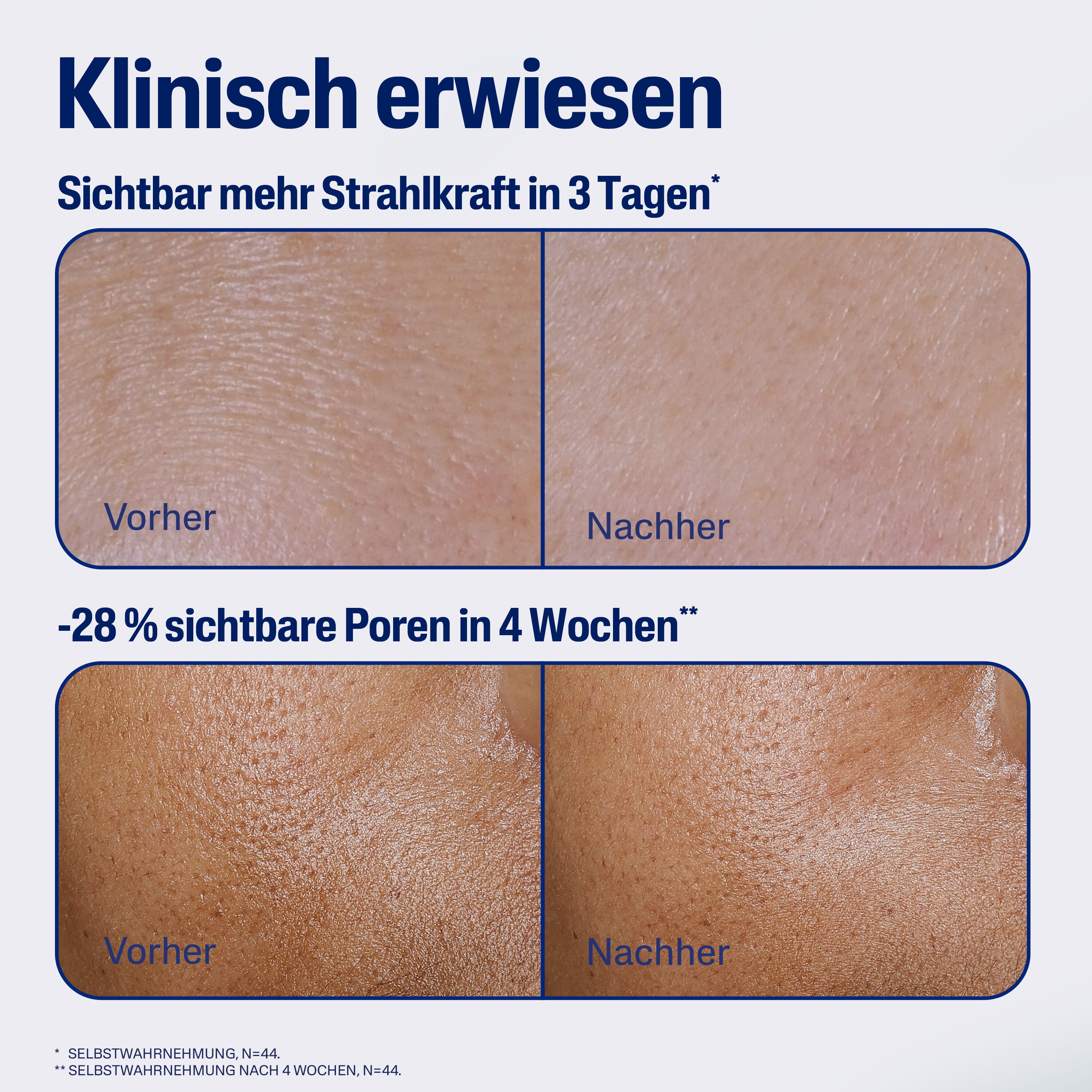 Cetaphil Repair Nachtserum (PM)